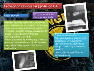 Proyección Oblicua PA ( posición OAI)
Chasis 8x10 cm
Posición: paciente en decúbito semiprono
con el lado derecho en contacto con la mesa
Hacer que el paciente descanse sobre el
antebrazo y la rodilla del lado elevado con la
cabeza en posición lateral izquierda
Girar al paciente (15 a 40°)
Ajustar el paciente de manera que la vesícula
quede en la línea de la mesa (la localización
exacta viene determinada por la placa
localizadora
RC: en la localización
exacta de la vesícula
Criterios de evaluación:
Debe visualizarse la vesícula bien
opacificada, sin movimientos
Debe observarse una zona que
incluya la vesícula y el conducto
colédoco
La vesícula a de estar libre de
superposiciones
 