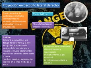 Proyección en decúbito lateral derecho
Chasis: 8x10 cmPuede demostrar la
existencia de múltiples
calcificaciones de
pequeño tamaño que no
se visualizan en otras
proyecciones
Posición:
Colocar 2 almohadillas, una
debajo de las caderas y la otra
debajo de los hombros del
paciente (ello permite que la
vesícula se mueva ligeramente)
Paciente en decúbito lateral sobre
la mesa
Hombros y caderas superpuestas
Vesícula en la línea media de la
mesa
RC: en la localización
exacta de la vesícula
La vesícula debe observarse
sin movimientos y
superpuesta,
ocasionalmente, a gas
intestinal
La colimación ajustada al
máximo
 