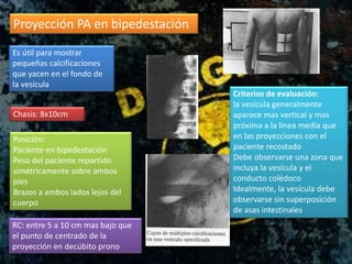 Proyección PA en bipedestación
Es útil para mostrar
pequeñas calcificaciones
que yacen en el fondo de
la vesícula
Chasis: 8x10cm
Posición:
Paciente en bipedestación
Peso del paciente repartido
simétricamente sobre ambos
pies
Brazos a ambos lados lejos del
cuerpo
RC: entre 5 a 10 cm mas bajo que
el punto de centrado de la
proyección en decúbito prono
Criterios de evaluación:
la vesícula generalmente
aparece mas vertical y mas
próxima a la línea media que
en las proyecciones con el
paciente recostado
Debe observarse una zona que
incluya la vesícula y el
conducto colédoco
Idealmente, la vesícula debe
observarse sin superposición
de asas intestinales
 