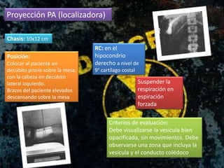 Proyección PA (localizadora)
Chasis: 10x12 cm
Posición:
Colocar al paciente en
decúbito prono sobre la mesa,
con la cabeza en decúbito
lateral izquierdo.
Brazos del paciente elevados
descansando sobre la mesa
RC: en el
hipocondrio
derecho a nivel de
9° cartílago costal
Suspender la
respiración en
espiración
forzada
Criterios de evaluación:
Debe visualizarse la vesícula bien
opacificada, sin movimientos. Debe
observarse una zona que incluya la
vesícula y el conducto colédoco
 