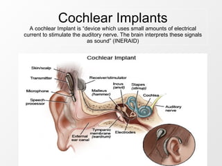 Cochlear Implants A cochlear Implant is “device which uses small amounts of electrical current to stimulate the auditory nerve. The brain interprets these signals as sound” (INERAID) 