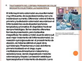 8.  El linfoma primario colorrectal es una enfermedad muy infrecuente, de causa desconocida y con una incidencia en aumento. Diferenciar entre el linfoma primario y la afectación colorrectal secundaria en el linfoma sistémico es de elevada importancia terapéutica y pronostica. El diagnóstico ha de ser siempre histológico. Se han descrito diferentes formas de presentación, pero todas ellas inespecíficas. No existe un total acuerdo sobre cuál es el mejor tratamiento del linfoma colorrectal. La resección quirúrgica suele ser el procedimiento de elección, sin haberse definido el papel de la quimioterapia. Presentamos un caso de linfoma primario localizado en el ciego, cuyas manifestaciones clínicas fueron meteorismo y saciedad precoz, siendo diagnosticado mediante colonoscopia y biopsia. La resección asistida por laparoscopia fue el tratamiento de elección. La no afectación ganglionar, tamaño tumoral, resección completa con márgenes libres, así como los factores de riesgo cardiopulmonares del paciente, llevaron a desestimar la quimioterapia adyuvante. Tras un año de seguimiento el paciente se encuentra libre de enfermedad . http://www.scielo.org.pe/scielo.php?pid=S1022-51292003000100008&script=sci_arttext 