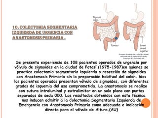Se presenta experiencia de 108 pacientes operados de urgencia por vólvulo de sigmoides en la ciudad de Potosí (1975-1987)en quienes se practico colectomia segmentaria izquierda o resección de sigmoides con Anastomosis Primaria sin la preparación habitual del colon. idos los pacientes operados presentan vólvulo de sigmoides, con diferentes grados de isquemia del asa comprometida. La anastomosis se realizo con sutura intraluminal y extralimitar en un solo plano con puntos separados de seda 000. Los resultados obtenidos con esta técnica nos inducen admitir a la Colectomia Segmentaria Izquierda de Emergencia con Anastomosis Primaria como adecuada e indicación directa para el vólvulo de Altura.(AU) 