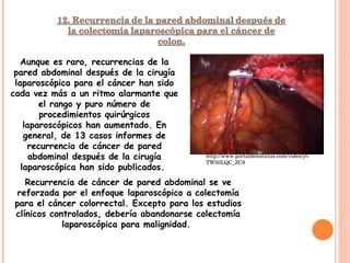 Aunque es raro, recurrencias de la pared abdominal después de la cirugía laparoscópica para el cáncer han sido cada vez más a un ritmo alarmante que el rango y puro número de procedimientos quirúrgicos laparoscópicos han aumentado. En general, de 13 casos informes de recurrencia de cáncer de pared abdominal después de la cirugía laparoscópica han sido publicados.  Recurrencia de cáncer de pared abdominal se ve reforzada por el enfoque laparoscópico a colectomía para el cáncer colorrectal. Excepto para los estudios clínicos controlados, debería abandonarse colectomía laparoscópica para malignidad.  http://www.portaldenoticias.com/video/yt-TW50LQC_ZC8 