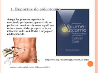 Aunque los primeros reportes de colectomía por laparoscopia asistida en pacientes con cáncer de colon sugirió que reduce la morbilidad preoperatoria, su influencia en los resultados a largo plazo es desconocida.  http://www.nap.edu/catalog.php?record_id=10160 http://www.butler.org/body.cfm?id=125&chunkiid=103912 