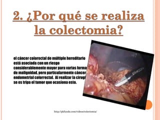 el cáncer colorectal de múltiple hereditario está asociada con un riesgo considerablemente mayor para varias formas de malignidad, pero particularmente cáncer endometrial colorrectal.  Al realizar la cirugía se es tripa el tumor que ocasiona esto. http://pkfunda.com/videos/colectomia/ 