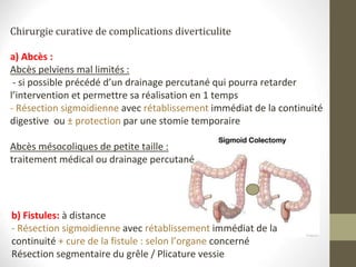 Chirurgie curative de complications diverticulite
a) Abcès :
Abcès pelviens mal limités :
- si possible précédé d’un drainage percutané qui pourra retarder
l’intervention et permettre sa réalisation en 1 temps
- Résection sigmoidienne avec rétablissement immédiat de la continuité
digestive ou ± protection par une stomie temporaire
Abcès mésocoliques de petite taille :
traitement médical ou drainage percutané
b) Fistules: à distance
- Résection sigmoidienne avec rétablissement immédiat de la
continuité + cure de la fistule : selon l’organe concerné
Résection segmentaire du grêle / Plicature vessie
 