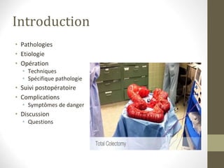 Introduction
• Pathologies
• Etiologie
• Opération
• Techniques
• Spécifique pathologie
• Suivi postopératoire
• Complications
• Symptômes de danger
• Discussion
• Questions
 