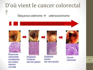 5
D’où vient le cancer colorectal
?
Muqueuse
colorectale
(revêtement
de surface
interne)
normale
Dysplasie
modérée
(de bas grade)
Dysplasie
sévère
(de haut grade)
Cancer
colorectal
Séquence adénome  adénocarcinome
Accumulation d’anomalies génétiques
 