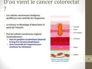 6
D’où vient le cancer colorectal
?
• Les cellules cancéreuses (malignes)
prolifèrent sans contrôle de l’organisme
• La tumeur se développe d’abord dans la
paroi de l’intestin
• Puis les cellules cancéreuses migrent
éventuellement :
• Dans les ganglions lymphatiques (disposés
le long d’un vaisseau lymphatique)
• Dans l’ensemble de l’organisme pour
constituer les métastases
 