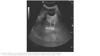Pickhardt, P. and Arluk, G. (n.d.). Atlas de Imágenes en Gastroenterología. 1st ed. Montoro Huguet, M. and García Pagán,
J. (2012). Gastroenterología y hepatología. 1st ed. Madrid: Jarpyo.Montoro Huguet, M. and García Pagán, J. (2012).
 