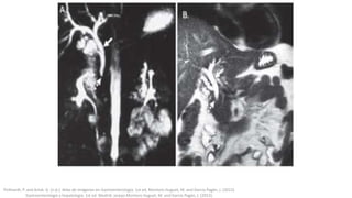 Pickhardt, P. and Arluk, G. (n.d.). Atlas de Imágenes en Gastroenterología. 1st ed. Montoro Huguet, M. and García Pagán, J. (2012).
Gastroenterología y hepatología. 1st ed. Madrid: Jarpyo.Montoro Huguet, M. and García Pagán, J. (2012).
 