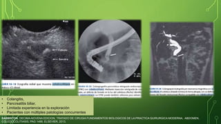 Coledoco litiasis | PPTX