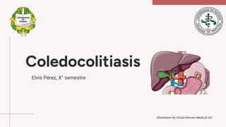 Coledocolitiasis
Elvis Pérez, X° semestre
Illustration by Smart-Servier Medical Art
 
