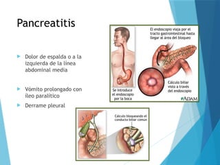 Pancreatitis
 Dolor de espalda o a la
izquierda de la línea
abdominal media
 Vómito prolongado con
íleo paralítico
 Derrame pleural
 