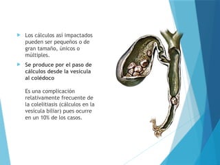  Los cálculos así impactados
pueden ser pequeños o de
gran tamaño, únicos o
múltiples.
 Se produce por el paso de
cálculos desde la vesícula
al colédoco
Es una complicación
relativamente frecuente de
la colelitiasis (cálculos en la
vesícula biliar) pues ocurre
en un 10% de los casos.
 
