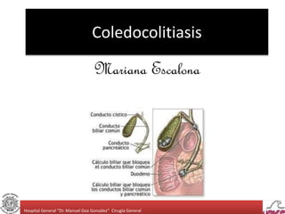 Coledocolitiasis 
Mariana Escalona 
Hospital General “Dr. Manuel Gea González” Cirugía General 
 