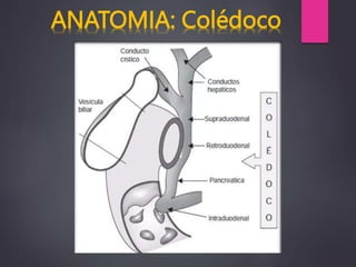 coledocolitiasis original DEL SERVICIO DE CIRUGIA.pptx