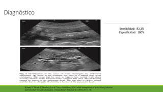 Diagnóstico
Sensibilidad: 83.3%
Especificidad: 100%
Kimura Y, Takada T, Strasberg S et al. Tokyo Guidelines 2018: initial management of acute biliary infection
and flowchart for acute cholangitis. J Hepatobiliary Pancreat Sci (2018) 25:31–40.
 