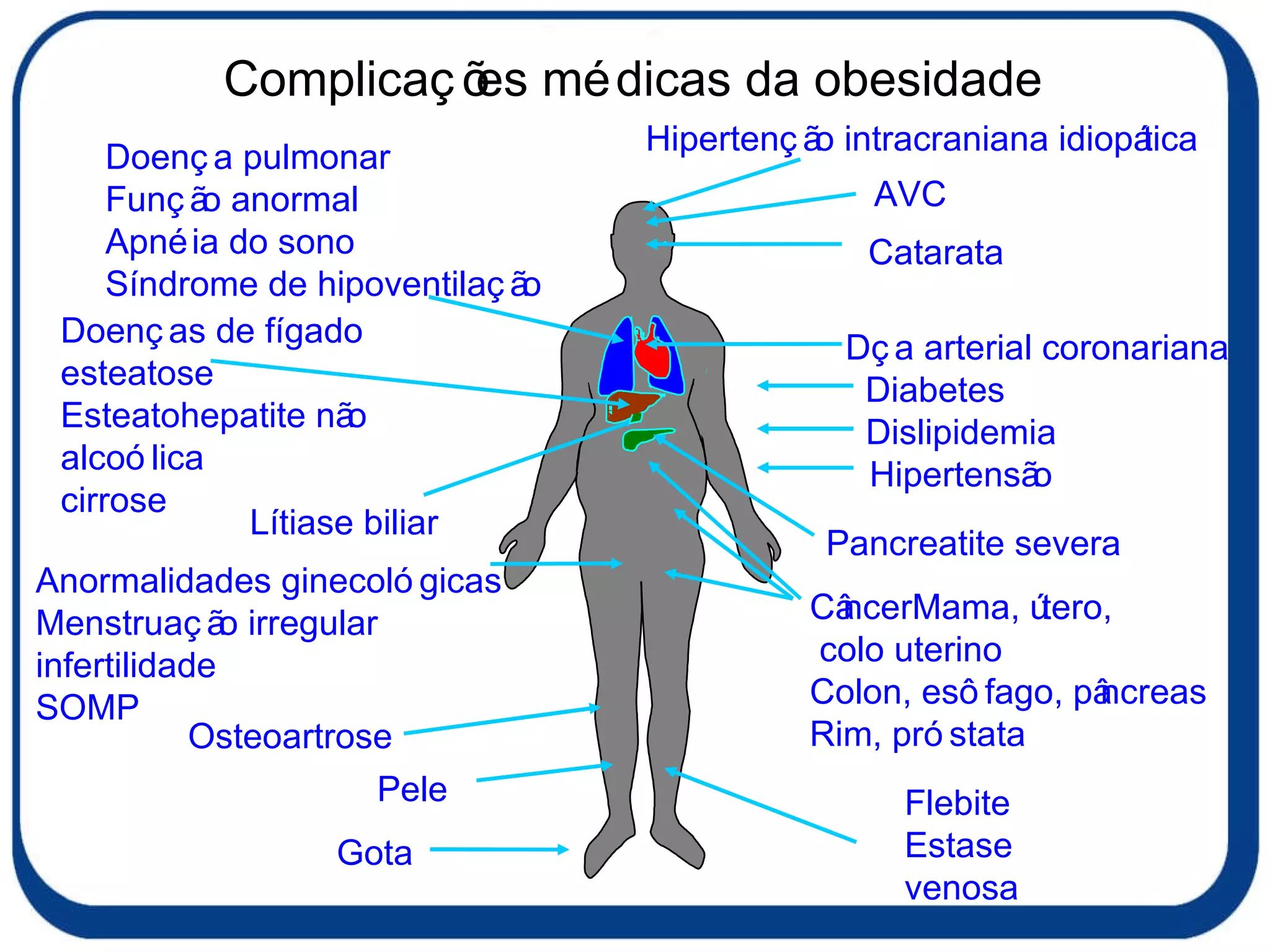 Complicações médicas da obesidade Flebite Estase venosa Dça arterial coronariana Doença pulmonar Função anormal Apnéia do sono Síndrome de hipoventilação Lítiase biliar Anormalidades ginecológicas Menstruação irregular infertilidade SOMP Gota  AVC Diabetes Osteoartrose CâncerMama, útero, colo uterino Colon, esôfago, pâncreas Rim, próstata Doenças de fígado esteatose Esteatohepatite não alcoólica cirrose Hipertensão Dislipidemia Catarata Pele Hipertenção intracraniana idiopática Pancreatite severa 