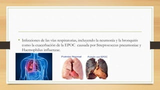 • Infecciones de las vías respiratorias, incluyendo la neumonía y la bronquitis
como la exacerbación de la EPOC causada por Streptococcus pneumoniae y
Haemophilus influenzae.
 