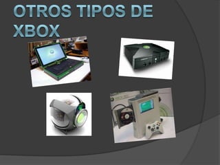 Otros tipos de Xbox