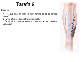 Tarefa 9 Observe A) Por que quando ficamos muito tempo de pé as pernas doem? B) Qual a função das válvulas venosas? C) Qual a relação entre as varizes e as válvulas venosas? 