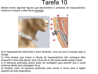 Tarefa 10 