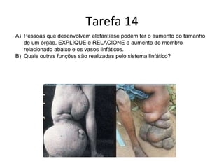 Tarefa 14 Pessoas que desenvolvem elefantíase podem ter o aumento do tamanho de um órgão, EXPLIQUE e RELACIONE o aumento do membro relacionado abaixo e os vasos linfáticos. Quais outras funções são realizadas pelo sistema linfático? 