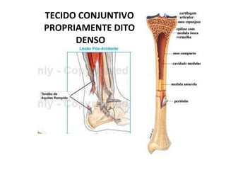 TECIDO CONJUNTIVO   PROPRIAMENTE DITO  DENSO 