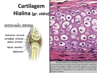 Cartilagem Hialina  (gr.  vidro ) 
