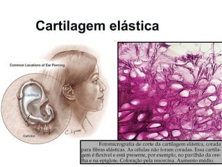 Cartilagem elástica 
