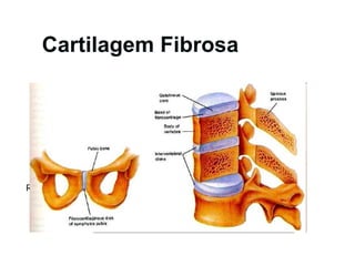 Cartilagem Fibrosa RER 