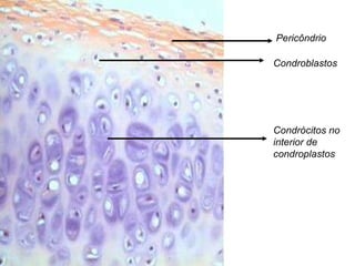 Pericôndrio Condroblastos Condrócitos no interior de condroplastos 