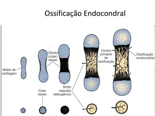 Ossificação Endocondral 