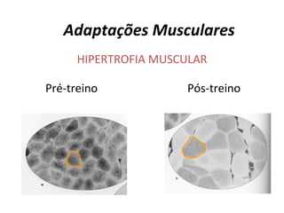 Adaptações Musculares HIPERTROFIA MUSCULAR Pré-treino Pós-treino 