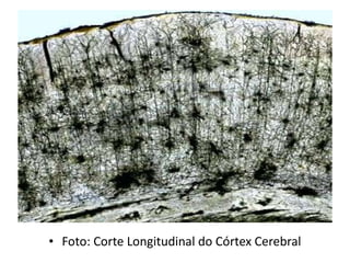 Foto: Corte Longitudinal do Córtex Cerebral 