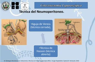 Colecistectomía Laparoscópica
Técnica del Neumoperitoneo.
•Aguja de Veress
(técnica cerrada),
•Técnica de
Hasson (técnica
abierta)
Dr. Rodriguez Montalvo et al. Indicaciones y Técnicas en Cirugía Laparoscópica Biliar. Cirugía Hepatobiliar. Capítulo 8. Venezuela. 2010.
 