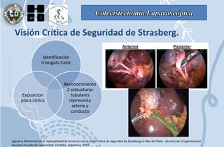 Colecistectomía Laparoscópica
VISIÓN
CRÍTICA DE
STRASBERG
Agostina Montanelli et al. Aplicabilidad de la técnica de la visión crítica de seguridad de Strasberg en Mar del Plata. Servicio de Cirugía General.
Hospital Privado de Comunidad, Córdoba. Argentina, 2019.
Visión Crítica de Seguridad de Strasberg.
Identificación
triangulo Calot
Reconocimiento
2 estructuras
tubulares
representa
arteria y
conducto
Exposicion
placa cistica
 