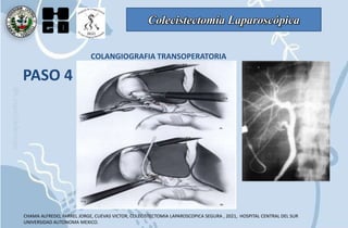 Colecistectomía Laparoscópica
PASO 4
COLANGIOGRAFIA TRANSOPERATORIA
CHAMA ALFREDO, FARREL JORGE, CUEVAS VICTOR, COLECISTECTOMIA LAPAROSCOPICA SEGURA , 2021, HOSPITAL CENTRAL DEL SUR
UNIVERSIDAD AUTONOMA MEXICO.
 