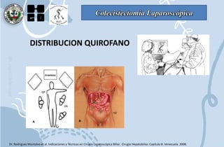 Colecistectomía Laparoscópica
DISTRIBUCION QUIROFANO
Dr. Rodriguez Montalvo et al. Indicaciones y Técnicas en Cirugía Laparoscópica Biliar. Cirugía Hepatobiliar. Capítulo 8. Venezuela. 2008.
 