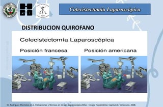 Colecistectomía Laparoscópica
DISTRIBUCION QUIROFANO
Dr. Rodriguez Montalvo et al. Indicaciones y Técnicas en Cirugía Laparoscópica Biliar. Cirugía Hepatobiliar. Capítulo 8. Venezuela. 2008.
 