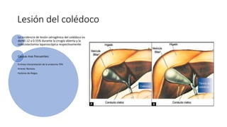 Comprehensive Guide to Laparoscopic and Difficult Cholecystectomy ...