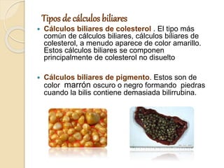 Tipos de cálculos biliares
 Cálculos biliares de colesterol . El tipo más
común de cálculos biliares, cálculos biliares de
colesterol, a menudo aparece de color amarillo.
Estos cálculos biliares se componen
principalmente de colesterol no disuelto
 Cálculos biliares de pigmento. Estos son de
color marrón oscuro o negro formando piedras
cuando la bilis contiene demasiada bilirrubina.
 