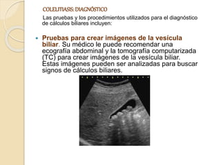 COLELITIASIS:DIAGNÓSTICO
Las pruebas y los procedimientos utilizados para el diagnóstico
de cálculos biliares incluyen:
 Pruebas para crear imágenes de la vesícula
biliar. Su médico le puede recomendar una
ecografía abdominal y la tomografía computarizada
(TC) para crear imágenes de la vesícula biliar.
Estas imágenes pueden ser analizadas para buscar
signos de cálculos biliares.
 
