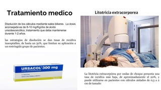 Tratamiento medico
Disolución de los cálculos mediante sales biliares. La dosis
aconsejada es de 8-10 mg/Kg/día de ácido
ursodesoxicólico, tratamiento que debe mantenerse
durante 1-2 años.
las estrategias de disolución se dan tasas de recidiva
inaceptables, de hasta un 50%, que limitan su aplicación a
un restringido grupo de pacientes.
Litotricia extracorporea
La litotricia extracorpórea por ondas de choque presenta una
tasa de recidiva más baja, de aproximadamente el 20%, y
puede utilizarse en pacientes con cálculos aislados de 0,5 a 2
cm de tamaño
 