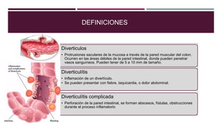 DEFINICIONES
Diverticulos
• Protrusiones saculares de la mucosa a través de la pared muscular del colon.
Ocurren en las ár...