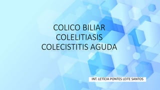 INT. LETÍCIA PONTES LEITE SANTOS
COLICO BILIAR
COLELITIASIS
COLECISTITIS AGUDA
 