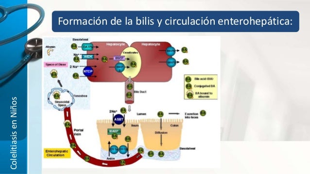 Colelitiasis en niños Colelitiasis en niños