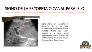 COLELITIASIS Clase De Medicina Para Estudiar PPTX COLELITIASIS Clase De Medicina Para Estudiar PPTX
